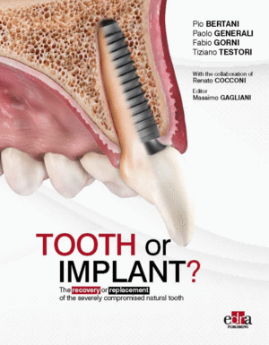 TOOTH OR IMPLANT. THE RECOVERY OR REPLACEMENT OF THE SEVERELY COMPROMISED NATURAL TOOTH
