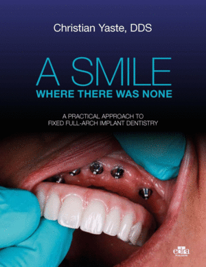 A SMILE WHERE THERE WAS NONE. A PRACTICAL APPROACH TO FIXED FULL-ARCH IMPLANT DENTISTRY