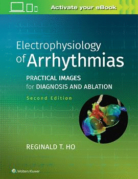 ELECTROPHYSIOLOGY OF ARRHYTHMIAS. PRACTICAL IMAGES FOR DIAGNOSIS AND ABLATION. 2ND EDITION