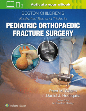 BOSTON CHILDREN’S ILLUSTRATED TIPS AND TRICKS  IN PEDIATRIC ORTHOPAEDIC FRACTURE SURGERY