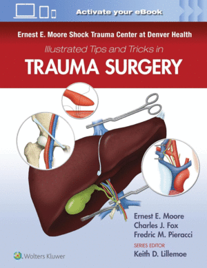 ERNEST E. MOORE SHOCK TRAUMA CENTER AT DENVER HEALTH ILLUSTRATED TIPS AND TRICKS IN TRAUMA SURGERY