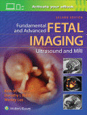 FUNDAMENTAL AND ADVANCED FETAL IMAGING ULTRASOUND AND MRI. 2ND EDITION