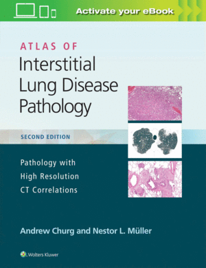 ATLAS OF INTERSTITIAL LUNG DISEASE PATHOLOGY. PATHOLOGY WITH HIGH RESOLUTION CT CORRELATIONS. 2ND EDITION