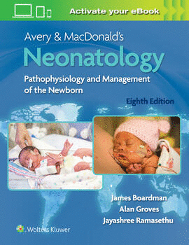 AVERY & MACDONALD'S NEONATOLOGY. PATHOPHYSIOLOGY AND MANAGEMENT OF THE NEWBORN. 8TH EDITION