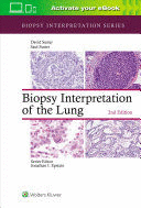 BIOPSY INTERPRETATION OF THE LUNG (BIOPSY INTERPRETATION SERIES). 2ND EDITION