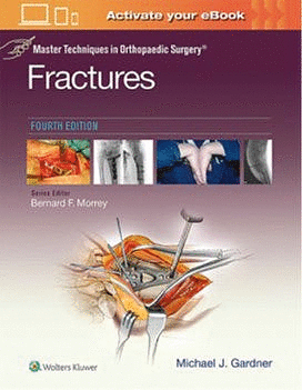 MASTER TECHNIQUES IN ORTHOPAEDIC SURGERY: FRACTURES. 4TH EDITION