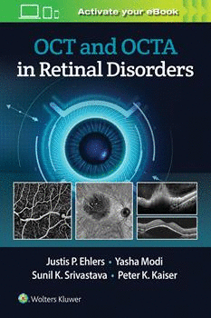 OCT AND OCTA IN RETINAL DISORDERS