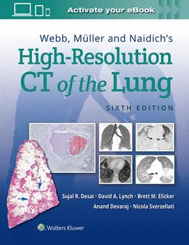 WEBB, MULLER AND NAIDICH'S HIGH RESOLUTION OF LUNG CT. 6TH EDITION