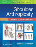 SHOULDER ARTHROPLASTY. PRINCIPLES AND PRACTICE