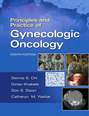 PRINCIPLES AND PRACTICE OF GYNECOLOGIC ONCOLOGY