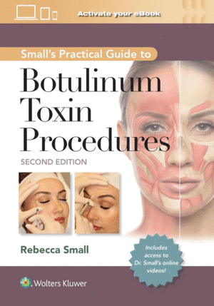 SMALL'S PRACTICAL GUIDE TO BOTULINUM TOXIN PROCEDURES. 2ND EDITION