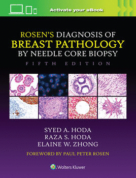 ROSEN'S DIAGNOSIS OF BREAST PATHOLOGY BY NEEDLE CORE BIOPSY. 5TH EDITION