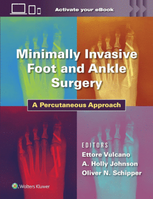 MINIMALLY INVASIVE FOOT AND ANKLE SURGERY. A PERCUTANEOUS APPROACH