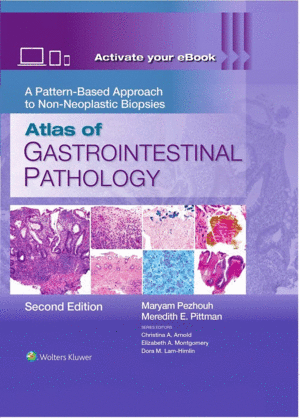 ATLAS OF GASTROINTESTINAL PATHOLOGY. A PATTERN-BASED APPROACH TO NON-NEOPLASTIC BIOPSIES. 2ND EDITION