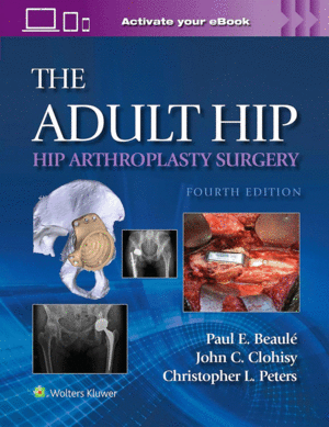 THE ADULT HIP. HIP ARTHROPLASTY SURGERY. 4TH EDITION