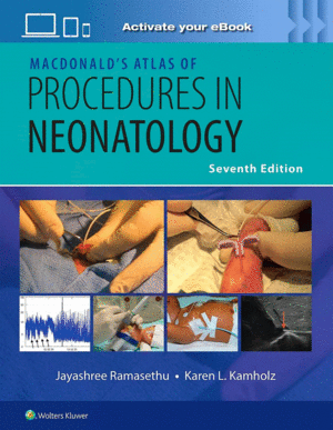 MACDONALD�S ATLAS OF PROCEDURES IN NEONATOLOGY PRINT + EBOOK WITH MULTIMEDIA