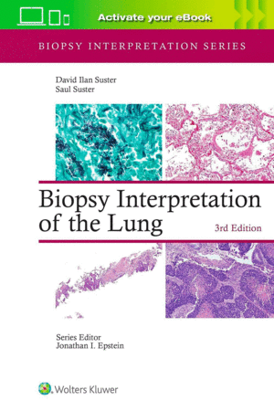 BIOPSY INTERPRETATION OF THE LUNG. 3RD EDITION