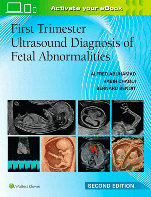 FIRST TRIMESTER ULTRASOUND DIAGNOSIS OF FETAL ABNORMALITIES