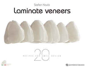 LAMINATE VENEER 20 RECIPES FOR SMILE DESIGN