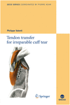 TENDON TRANSFER FOR IRREPARABLE CUFF TEAR