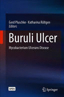 BURULI ULCER. MYCOBACTERIUM ULCERANS DISEASE