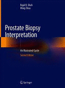 PROSTATE BIOPSY INTERPRETATION. AN ILLUSTRATED GUIDE. 2ND EDITION