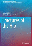 FRACTURES OF THE HIP. (SOFTCOVER)