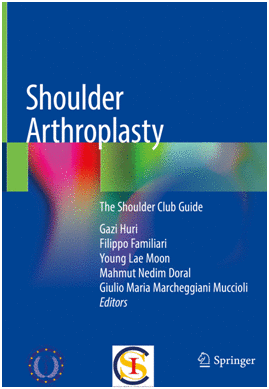 SHOULDER ARTHROPLASTY. THE SHOULDER CLUB GUIDE