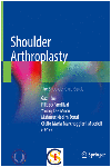SHOULDER ARTHROPLASTY. THE SHOULDER CLUB GUIDE. (SOFTCOVER)