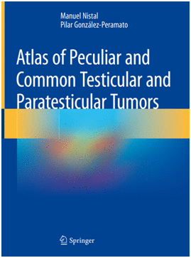 ATLAS OF PECULIAR AND COMMON TESTICULAR AND PARATESTICULAR TUMORS