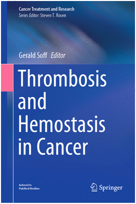 THROMBOSIS AND HEMOSTASIS IN CANCER. (SOFTCOVER)