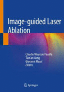 IMAGE-GUIDED LASER ABLATION. (SOFTCOVER)