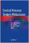 CENTRAL NERVOUS SYSTEM METASTASES. (SOFTCOVER)