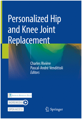PERSONALIZED HIP AND KNEE JOINT REPLACEMENT
