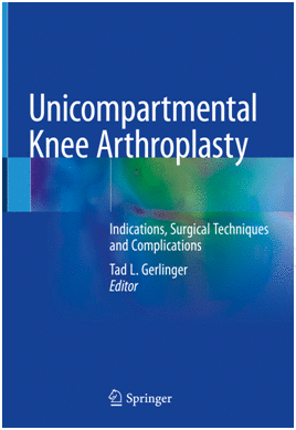 UNICOMPARTMENTAL KNEE ARTHROPLASTY. INDICATIONS, SURGICAL TECHNIQUES AND COMPLICATIONS. (SOFTCOVER)