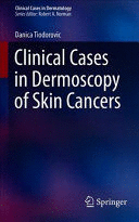 CLINICAL CASES IN DERMOSCOPY OF SKIN CANCERS (CLINICAL CASES IN DERMATOLOGY)