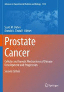 PROSTATE CANCER. CELLULAR AND GENETIC MECHANISMS OF DISEASE DEVELOPMENT AND PROGRESSION. 2ND EDITION