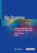 HIP DYSPLASIA. UNDERSTANDING AND TREATING INSTABILITY OF THE NATIVE HIP