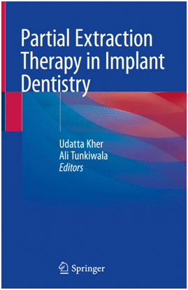 PARTIAL EXTRACTION THERAPY IN IMPLANT DENTISTRY