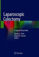 LAPAROSCOPIC COLECTOMY. A STEP BY STEP GUIDE