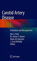 CAROTID ARTERY DISEASE. EVALUATION AND MANAGEMENT