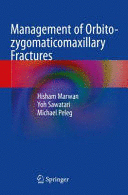 MANAGEMENT OF ORBITO-ZYGOMATICOMAXILLARY FRACTURES. (SOFTCOVER)