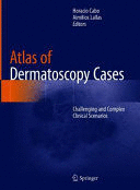 ATLAS OF DERMATOSCOPY CASES. CHALLENGING AND COMPLEX CLINICAL SCENARIOS