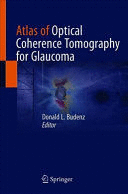 ATLAS OF OPTICAL COHERENCE TOMOGRAPHY FOR GLAUCOMA