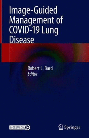 IMAGE-GUIDED MANAGEMENT OF COVID-19 LUNG DISEASE