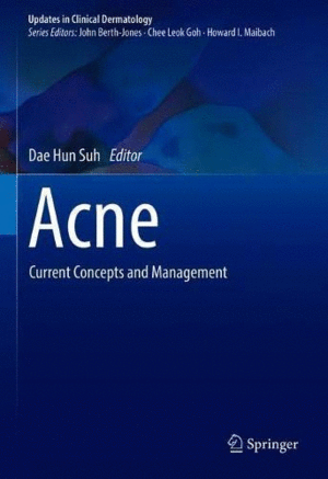 ACNE. CURRENT CONCEPTS AND MANAGEMENT
