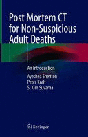 POST MORTEM CT FOR NON-SUSPICIOUS ADULT DEATHS. AN INTRODUCTION