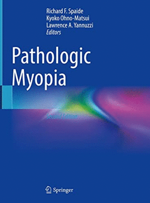 PATHOLOGIC MYOPIA. 2ND EDITION