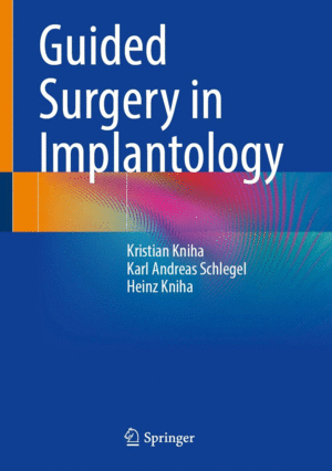 GUIDED SURGERY IN IMPLANTOLOGY