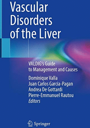 VASCULAR DISORDERS OF THE LIVER. VALDIG'S GUIDE TO MANAGEMENT AND CAUSES